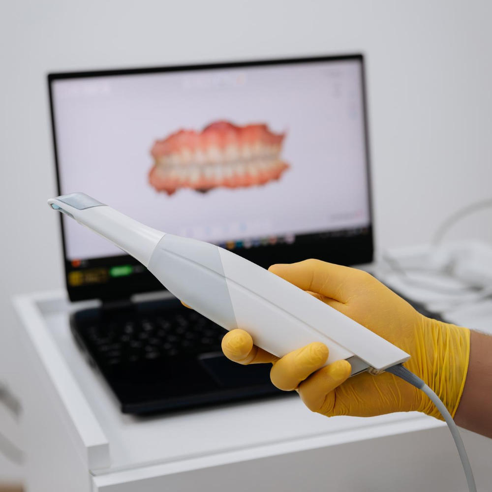 Intraoralscanner quadr